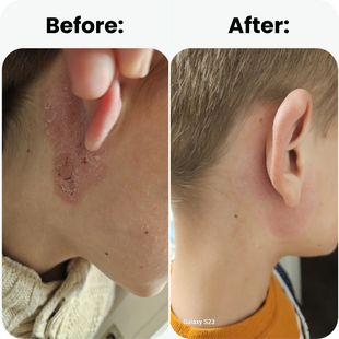 visible texture improvement